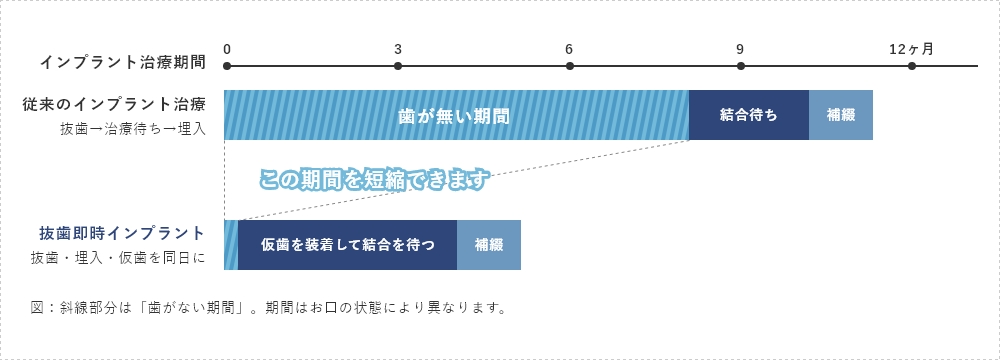 「歯がない期間」が、ここまで変わります